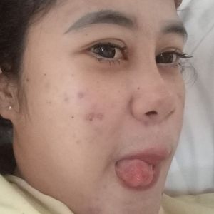 UMMI99